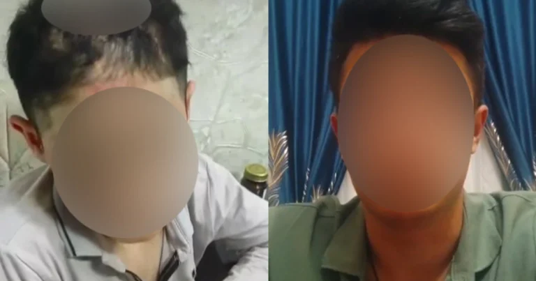 14 yaşlı yeniyetmənin qardaşı: “Həmin işgəncələri atam edib”