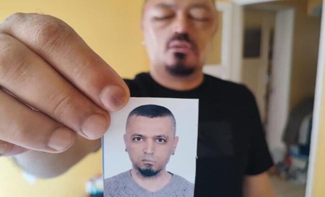 İnternetdən aldığı şampun həyatını kabusa çevirdi – FOTO