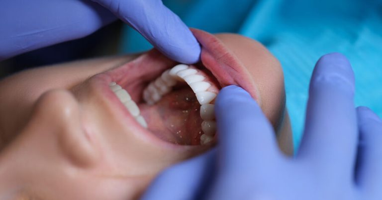 Diş itkisinə səbəb ola biləcək simptomlar bunlardır