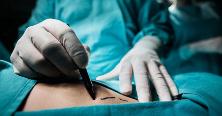 Azərbaycanda “TikToker” yayım açıb plastik əməliyyata pul yığdı – izləyiciləri təhqir etdi – FOTO