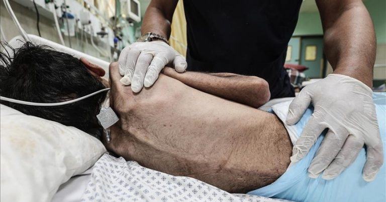 Qəzza zolağında aclıqdan ölənlərin sayı 404-ə çatdı