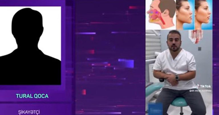 500 manat ziyana düşdü, az qaldı ölsün – “TikTok Stomatoloqu” barəsində AĞIR İDDİA – VİDEO