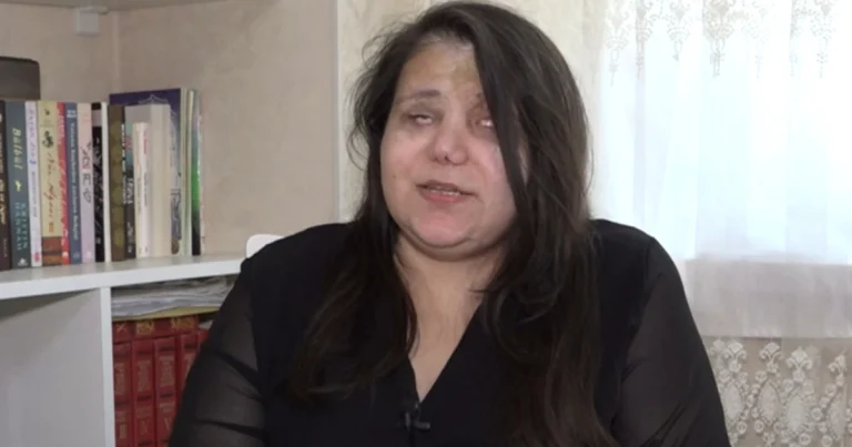Gəncə terrorunda gözlərini itirən qadın başına gələnləri danışdı: “Qoymayın ölüm, qızlarım var”