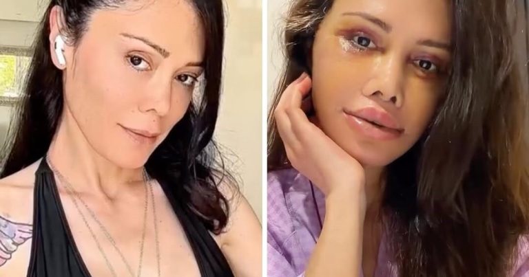 Əməliyyatla üzünü dəyişdirdi, tanınmaz hala düşdü – FOTO