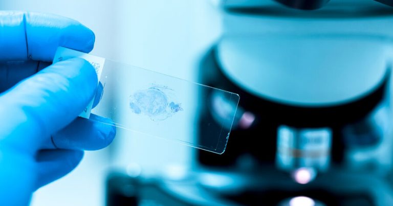 Alimlər xərçəng müalicəsinin səhər saatlarında aparılmasının sağqalma müddətini uzatdığını müəyyən ediblər