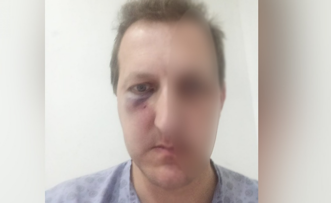 Əməkdar artistdən oğlunu döyənlərin həbs edilməməsinə etiraz