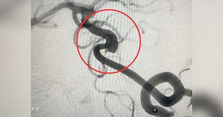 Ürək və qan-damar sistemi üçün təhlükəli olan məhsullar açıqlanıb