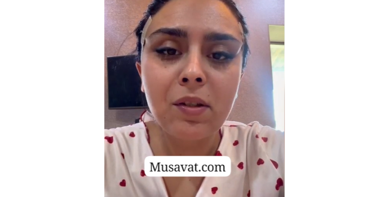 “Dr. Gülü”nün növbəti QURBANI görünməz halda: “TikTok reklamına inandım, üz sinirlərim zədələndi”- VİDEOFAKT